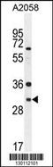 ARV1 Homolog, Fatty Acid Homeostasis Modulator antibody, MBS9208504, MyBioSource, Western Blot image 