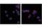 Transmembrane Protein 173 antibody, 41622S, Cell Signaling Technology, Immunocytochemistry image 