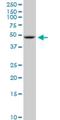 Solute Carrier Family 2 Member 11 antibody, H00081031-M02, Novus Biologicals, Western Blot image 