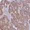 WD Repeat Domain 17 antibody, NBP1-90965, Novus Biologicals, Immunohistochemistry frozen image 