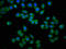 Kyphoscoliosis Peptidase antibody, CSB-PA012702LA01HU, Cusabio, Immunofluorescence image 