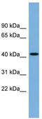 WD Repeat And FYVE Domain Containing 1 antibody, TA344756, Origene, Western Blot image 