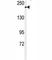 Transient Receptor Potential Cation Channel Subfamily M Member 7 antibody, F40171-0.4ML, NSJ Bioreagents, Western Blot image 