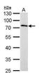 Matrix Metallopeptidase 16 antibody, NBP1-33102, Novus Biologicals, Western Blot image 