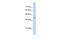 ST6 N-Acetylgalactosaminide Alpha-2,6-Sialyltransferase 6 antibody, PA5-69431, Invitrogen Antibodies, Western Blot image 