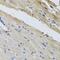 Ferrochelatase antibody, GTX65973, GeneTex, Immunohistochemistry paraffin image 