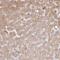 Chromosome 14 Open Reading Frame 178 antibody, NBP2-32364, Novus Biologicals, Immunohistochemistry paraffin image 