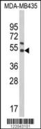 Killer Cell Immunoglobulin Like Receptor, Two Ig Domains And Short Cytoplasmic Tail 4 antibody, LS-B14405, Lifespan Biosciences, Western Blot image 