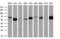 Fyn Related Src Family Tyrosine Kinase antibody, GTX84483, GeneTex, Western Blot image 