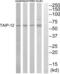 Cysteine And Serine Rich Nuclear Protein 2 antibody, abx015106, Abbexa, Western Blot image 