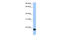 Putative zinc finger protein 833 antibody, 30-612, ProSci, Enzyme Linked Immunosorbent Assay image 