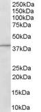 ArfGAP With Dual PH Domains 1 antibody, EB06120, Everest Biotech, Western Blot image 
