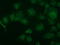 Tripartite Motif Containing 2 antibody, LS-C784918, Lifespan Biosciences, Immunofluorescence image 