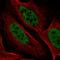 YdjC Chitooligosaccharide Deacetylase Homolog antibody, HPA061005, Atlas Antibodies, Immunofluorescence image 