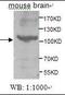 ACK1 antibody, orb95223, Biorbyt, Western Blot image 