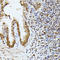 Heterogeneous Nuclear Ribonucleoprotein L antibody, A03769-1, Boster Biological Technology, Immunohistochemistry frozen image 