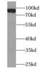 BTB Domain And CNC Homolog 1 antibody, abx230783, Abbexa, Western Blot image 