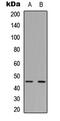 Glycogen Synthase Kinase 3 Beta antibody, abx121488, Abbexa, Western Blot image 