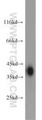 Aldolase, Fructose-Bisphosphate B antibody, 18065-1-AP, Proteintech Group, Western Blot image 