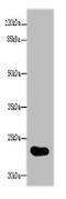 Gamma-Glutamyltransferase Light Chain 2 antibody, A62642-100, Epigentek, Western Blot image 