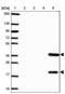 Transmembrane Protein 189 antibody, PA5-63746, Invitrogen Antibodies, Western Blot image 