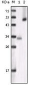 Glycogen Synthase Kinase 3 Alpha antibody, abx015750, Abbexa, Enzyme Linked Immunosorbent Assay image 