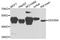 DExD-Box Helicase 39A antibody, A7955, ABclonal Technology, Western Blot image 