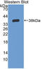 Interleukin 6 Receptor antibody, LS-C372820, Lifespan Biosciences, Western Blot image 