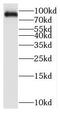 Poly(ADP-Ribose) Polymerase Family Member 9 antibody, FNab06160, FineTest, Western Blot image 