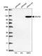 NOP2/Sun RNA Methyltransferase 2 antibody, NBP1-82189, Novus Biologicals, Western Blot image 