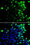 SLAM Family Member 7 antibody, LS-C749156, Lifespan Biosciences, Immunofluorescence image 