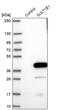 Sulfotransferase Family 1E Member 1 antibody, PA5-55797, Invitrogen Antibodies, Western Blot image 