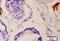 Collagen Type X Alpha 1 Chain antibody, orb312179, Biorbyt, Immunohistochemistry paraffin image 