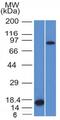 Coagulation Factor XIII A Chain antibody, GTX34714, GeneTex, Western Blot image 