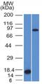 Coagulation factor XIII A chain antibody, GTX34714, GeneTex, Western Blot image 