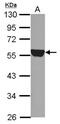 Aldehyde Dehydrogenase 1 Family Member A1 antibody, NBP2-15334, Novus Biologicals, Western Blot image 