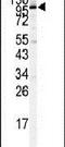 Signal Transducer And Activator Of Transcription 2 antibody, PA5-11629, Invitrogen Antibodies, Western Blot image 