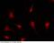 Musashi RNA Binding Protein 1 antibody, 100587-T10, Sino Biological, Immunohistochemistry paraffin image 