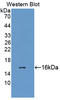 Lysyl Oxidase Like 2 antibody, LS-C718759, Lifespan Biosciences, Western Blot image 