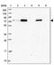 Zinc Finger Protein 417 antibody, PA5-59880, Invitrogen Antibodies, Western Blot image 
