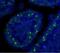 Cyclin-dependent kinase inhibitor 2A, isoforms 1/2/3 antibody, MA1-16665, Invitrogen Antibodies, Immunohistochemistry paraffin image 