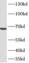 Transmembrane Protein 108 antibody, FNab08746, FineTest, Western Blot image 