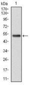 Glutathione S-Transferase Mu 1 antibody, NBP2-22186, Novus Biologicals, Western Blot image 