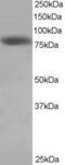 NDC80 Kinetochore Complex Component antibody, GTX23393, GeneTex, Western Blot image 