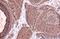 Thymidine Kinase 1 antibody, GTX113281, GeneTex, Immunohistochemistry paraffin image 