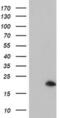 ADP Ribosylation Factor Like GTPase 5B antibody, MA5-25832, Invitrogen Antibodies, Western Blot image 