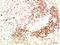 Janus Kinase 2 antibody, STJ98897, St John