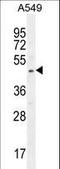 SRY-Box 3 antibody, LS-C161401, Lifespan Biosciences, Western Blot image 