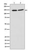 PHD Finger Protein 8 antibody, M03288, Boster Biological Technology, Western Blot image 