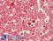 Ferritin Light Chain antibody, LS-B14971, Lifespan Biosciences, Immunohistochemistry paraffin image 
